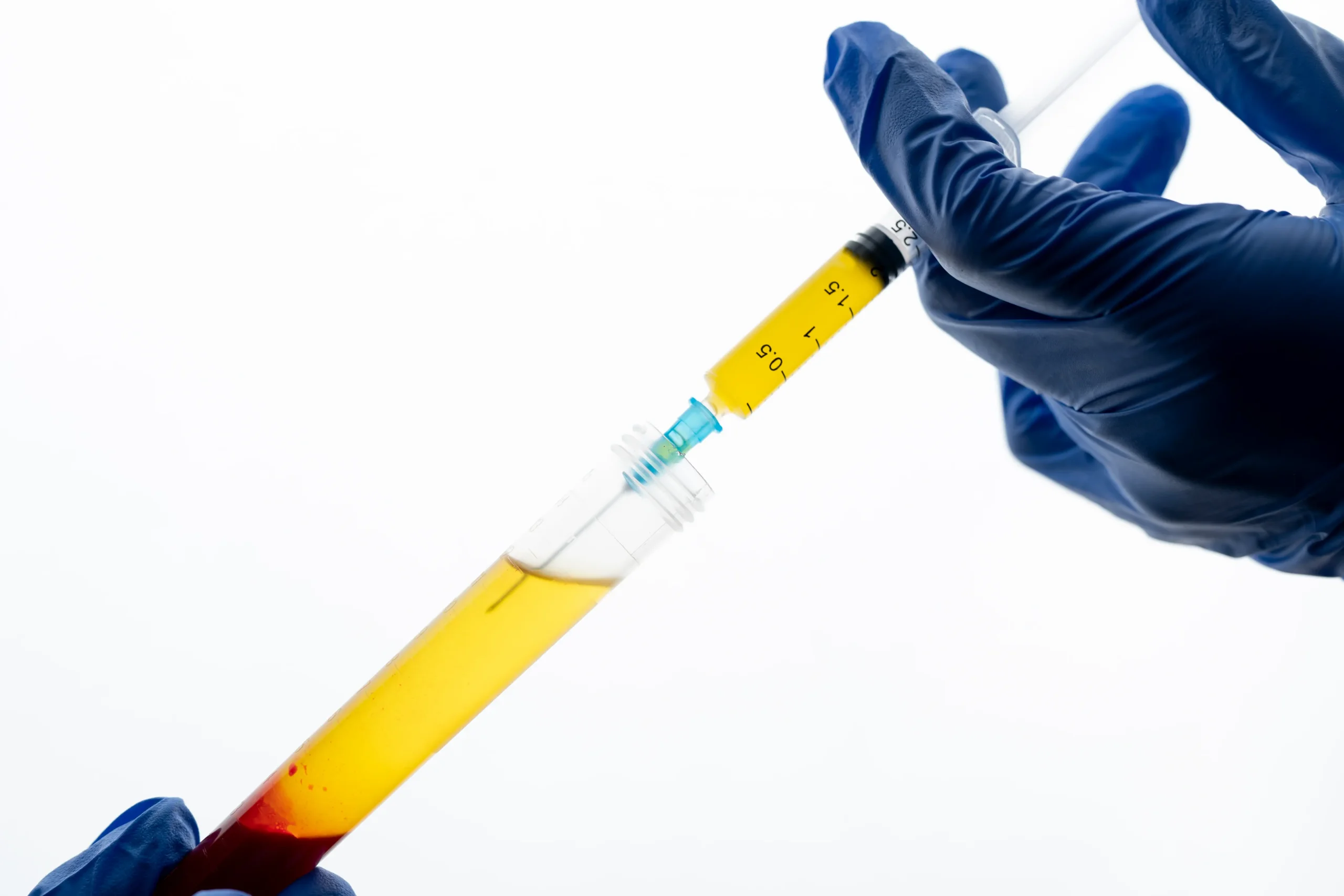 Pre-filled Syringes Leak Detection with Vacuum Decay Vs MicroCurrent HVLD Test Methods
